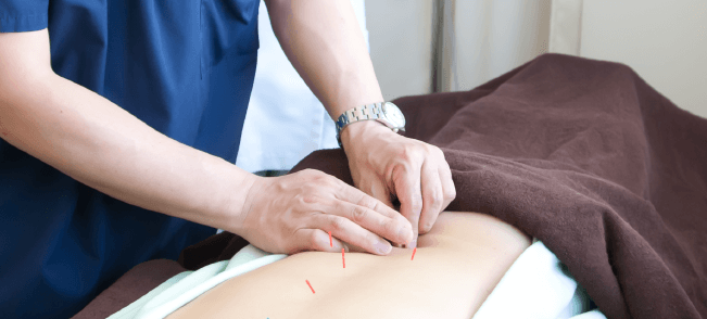 一般鍼灸