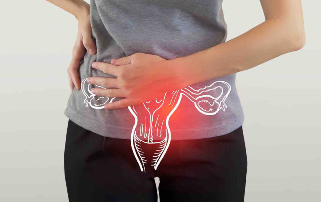 子宮筋腫と漢方について